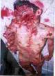 Palestinian victim of Israeli holocaust